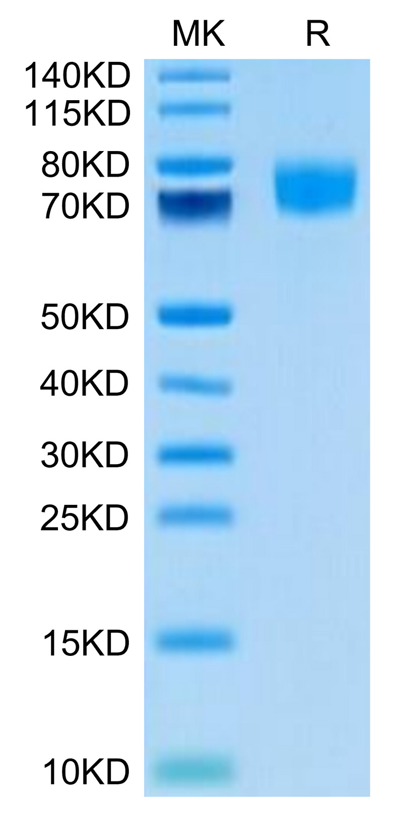 Biotinylated Human ALCAM (Primary Amine Labeling) on Tris-Bis PAGE under reduced condition. The purity is greater than 95%.Biotinylated Human ALCAM/CD166 Protein (Primary Amine Labeling), Active