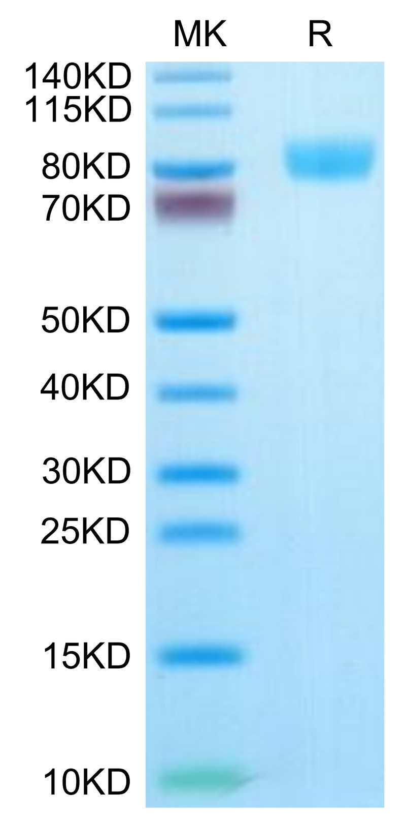 Human IL-17R alpha on Tris-Bis PAGE under reduced condition. The purity is greater than 95%.Recombinant Human IL-17R alpha/CD217 Protein, Active