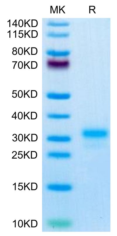 Mouse IL-17F on Tris-Bis PAGE under reduced condition. The purity is greater than 95%.Recombinant Mouse IL-17F Protein, Active