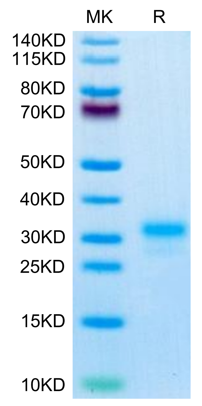 Mouse IL-17F on Tris-Bis PAGE under reduced condition. The purity is greater than 95%.Recombinant Mouse IL-17F Protein, Active