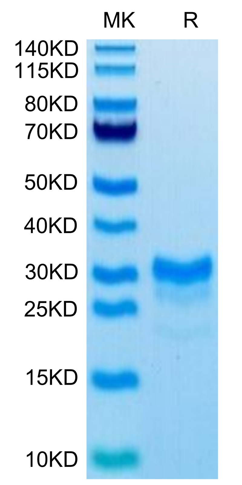 Biotinylated Mouse IL-17F on Tris-Bis PAGE under reduced condition. The purity is greater than 95%.Biotinylated Mouse IL-17F Protein, Active