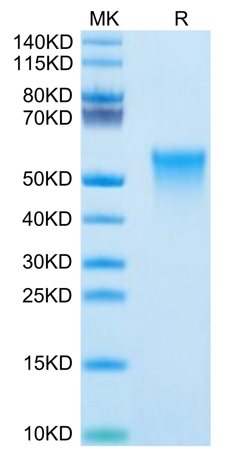 Mouse OX40 on Tris-Bis PAGE under reduced condition. The purity is greater than 95%.Recombinant Mouse OX40/TNFRSF4/CD134 Protein, Active