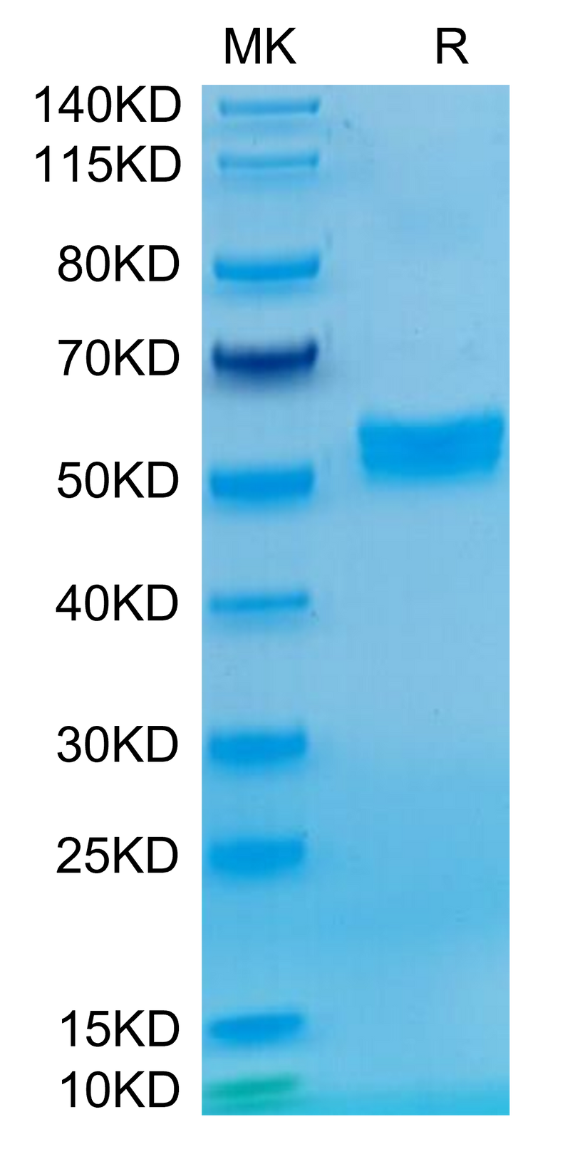 Chimeric HLA-A*02:01 (mα3) &B2M&WT-1 (RMFPNAPYL) Monomer on Tris-Bis PAGE under reduced condition. The purity is greater than 95%.Recombinant Chimeric HLA-A*02:01 (mα3) &B2M&WT-1 (RMFPNAPYL) Monomer Protein, Active