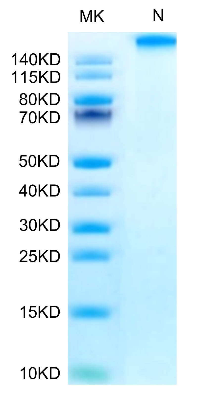 Chimeric HLA-A*02:01 (mα3) &B2M&WT-1 (RMFPNAPYL) Tetramer on Tris-Bis PAGE under Non reducing (N) condition. The purity is greater than 95%.Recombinant Chimeric HLA-A*02:01 (mα3) &B2M&WT-1 (RMFPNAPYL) Tetramer Protein, Active
