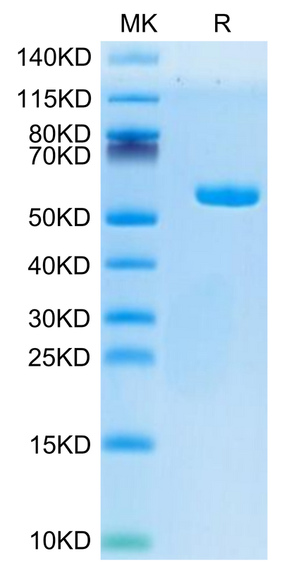 Human HLA-A*02:01&B2M&AFP (PLFQVPEPV) Monomer on Tris-Bis PAGE under reduced condition. The purity is greater than 95%.Recombinant Human HLA-A*02:01&B2M&AFP (PLFQVPEPV) Monomer Protein