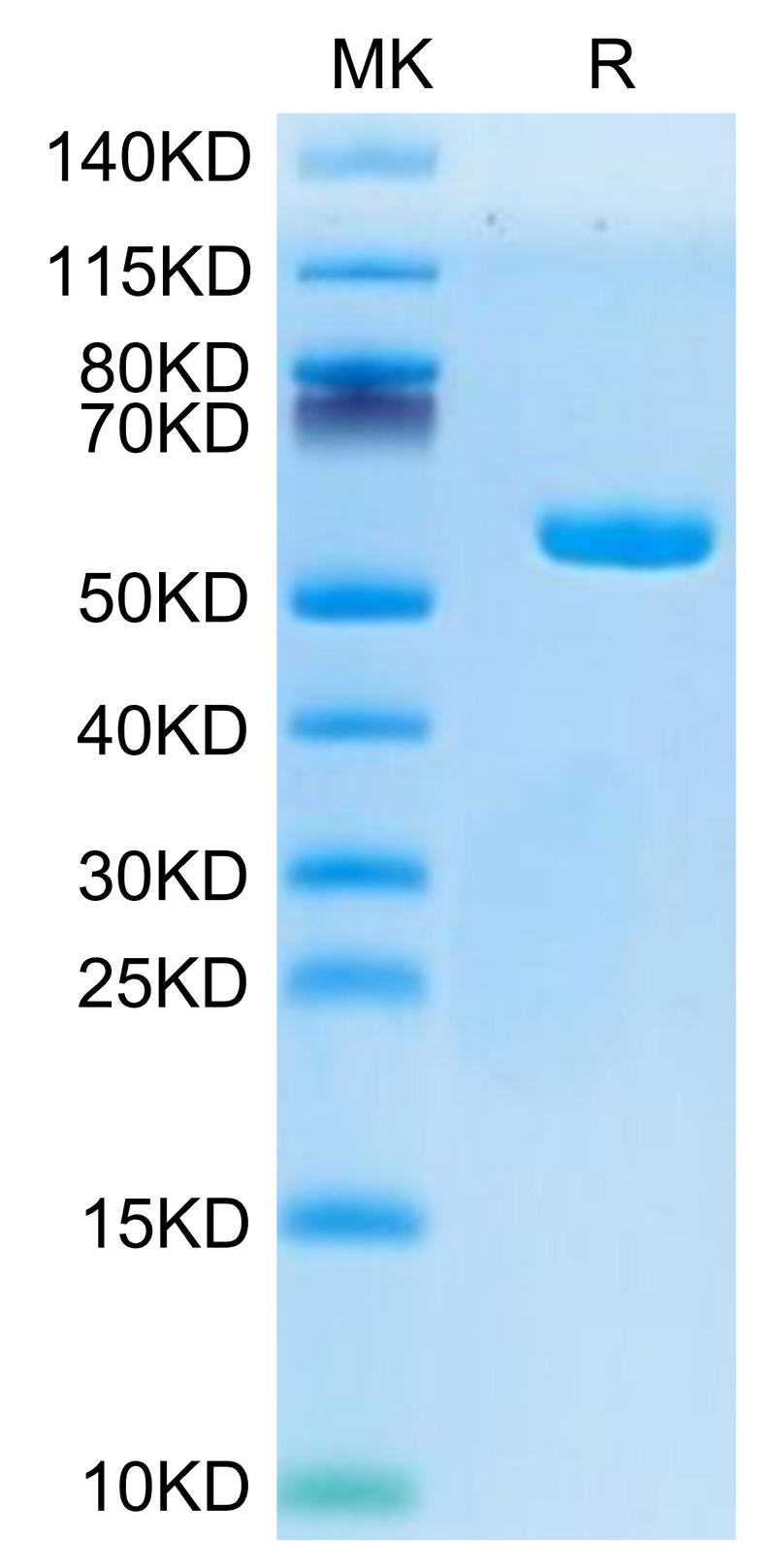 Human HLA-A*02:01&B2M&AFP (PLFQVPEPV) Monomer on Tris-Bis PAGE under reduced condition. The purity is greater than 95%.Recombinant Human HLA-A*02:01&B2M&AFP (PLFQVPEPV) Monomer Protein