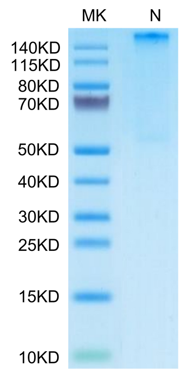 Human HLA-A*02:01&B2M&AFP (PLFQVPEPV) Tetramer on Tris-Bis PAGE under Non reducing (N) condition. The purity is greater than 95%.Recombinant Human HLA-A*02:01&B2M&AFP (PLFQVPEPV) Tetramer Protein