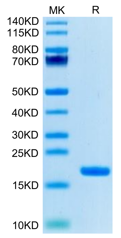 Biotinylated Human IL-18 on Tris-Bis PAGE under reduced condition. The purity is greater than 95%.Biotinylated Human IL-18 Protein (Primary Amine Labeling), Active