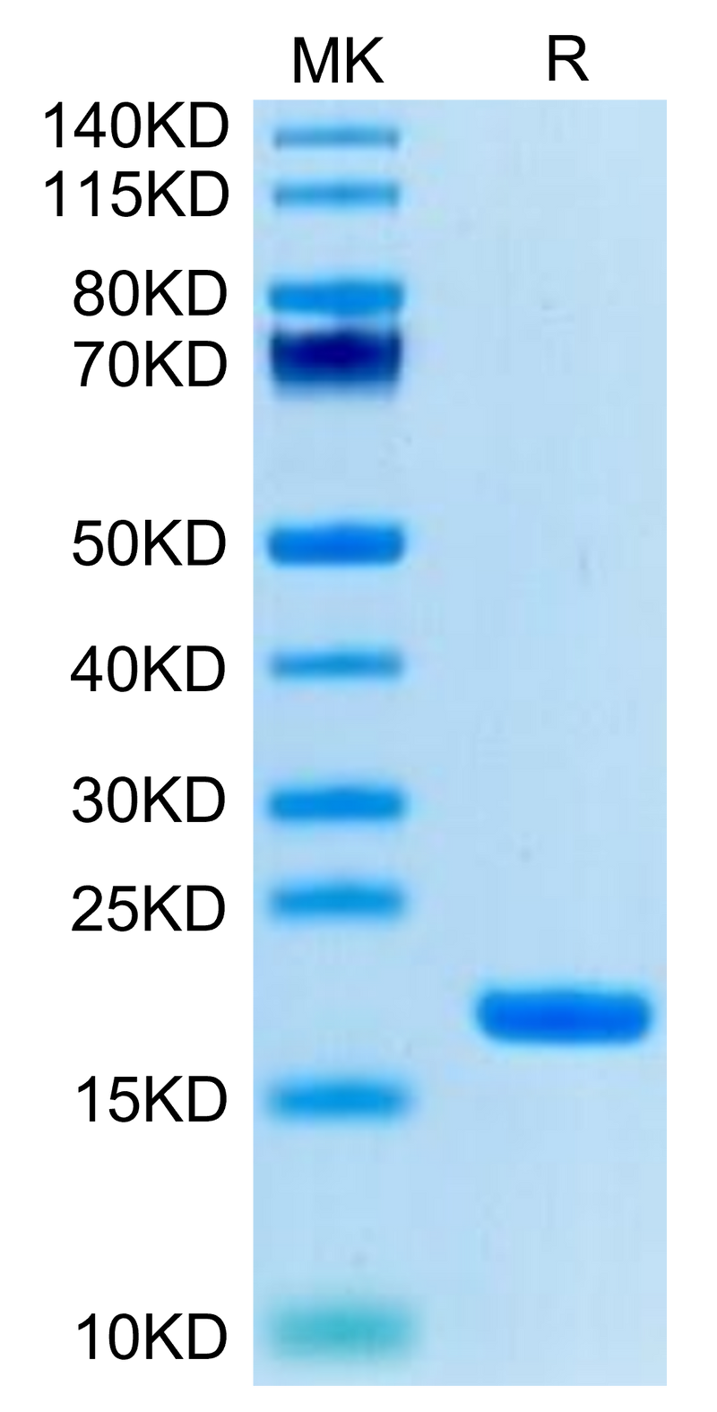 Biotinylated Human IL-18 on Tris-Bis PAGE under reduced condition. The purity is greater than 95%.Biotinylated Human IL-18 Protein (Primary Amine Labeling), Active