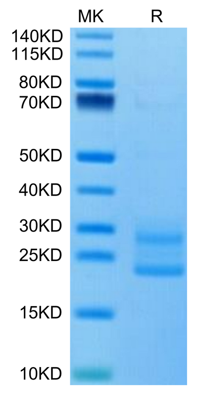 Mouse IL-17A&F on Tris-Bis PAGE under reduced condition. The purity is greater than 95%.Recombinant Mouse IL-17A&F Protein, Active