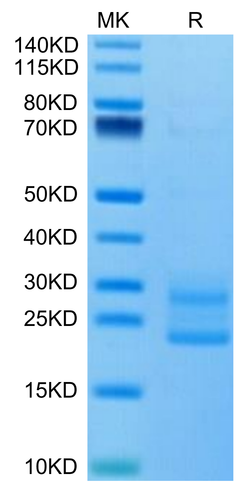 Mouse IL-17A&F on Tris-Bis PAGE under reduced condition. The purity is greater than 95%.Recombinant Mouse IL-17A&F Protein, Active