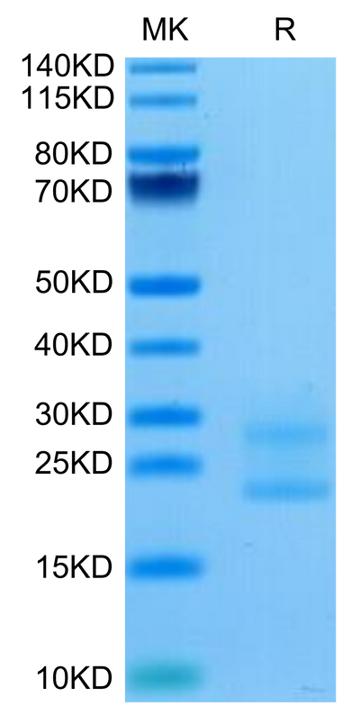 Biotinylated Mouse IL-17A&F on Tris-Bis PAGE under reduced condition. The purity is greater than 95%.Biotinylated Mouse IL-17A&F Protein, Active