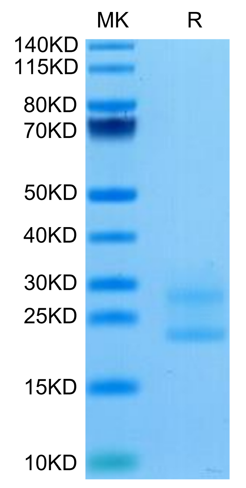 Biotinylated Mouse IL-17A&F on Tris-Bis PAGE under reduced condition. The purity is greater than 95%.Biotinylated Mouse IL-17A&F Protein, Active