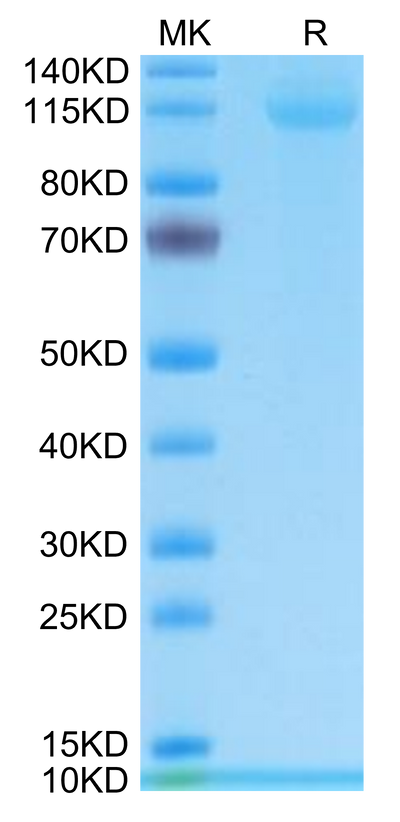 Human CD42b on Tris-Bis PAGE under reduced condition. The purity is greater than 95%.Recombinant Human CD42b/GP1BA Protein, Active