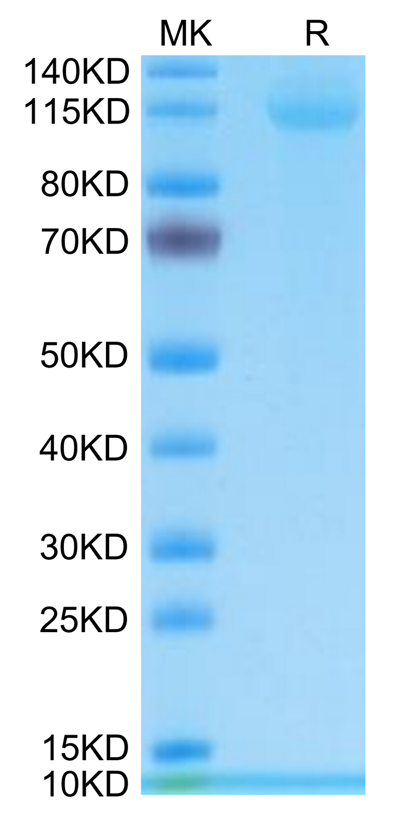 Human CD42b on Tris-Bis PAGE under reduced condition. The purity is greater than 95%.Recombinant Human CD42b/GP1BA Protein, Active