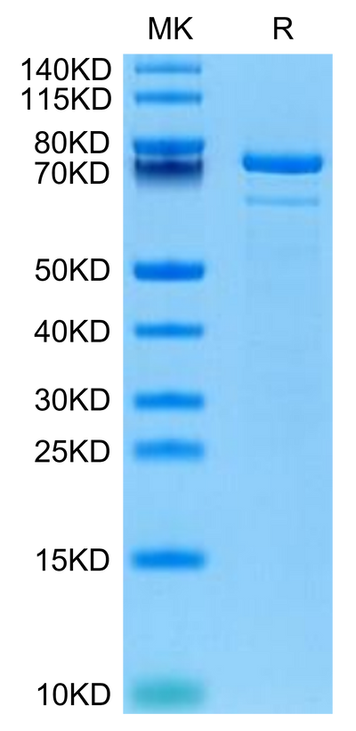 Human TGM2 on Tris-Bis PAGE under reduced condition. The purity is greater than 95%.Recombinant Human TGM2 Protein, Active