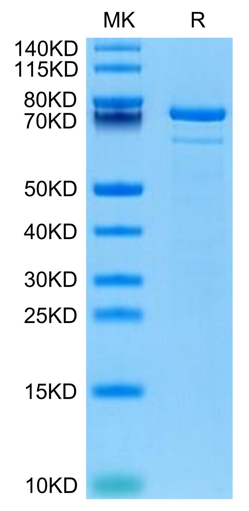 Human TGM2 on Tris-Bis PAGE under reduced condition. The purity is greater than 95%.Recombinant Human TGM2 Protein, Active