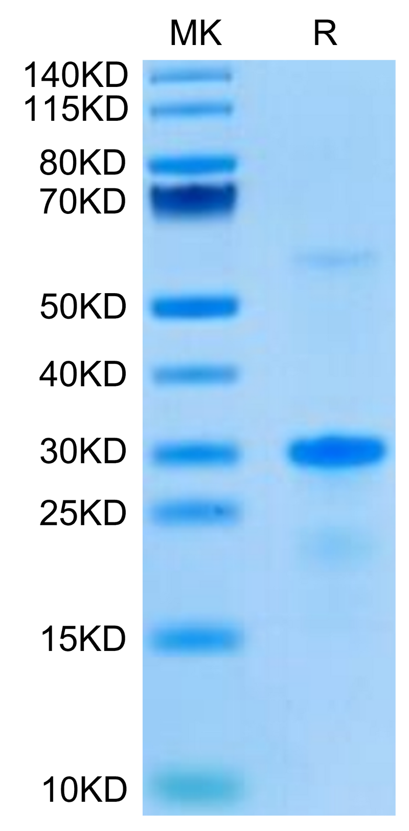Human EGFL7 on Tris-Bis PAGE under reduced condition. The purity is greater than 95%.Recombinant Human EGFL7 Protein, Active