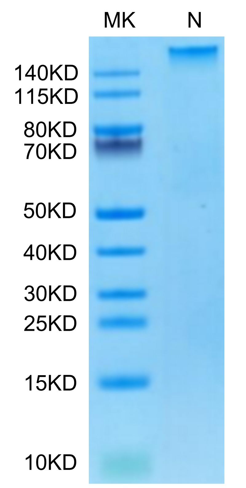 Human HLA-A*02:01&B2M&AFP (FMNKFIYEI) Tetramer on Tris-Bis PAGE under Non reducing (N) condition. The purity is greater than 95%.Recombinant Human HLA-A*02:01&B2M&AFP (FMNKFIYEI) Tetramer Protein, Active