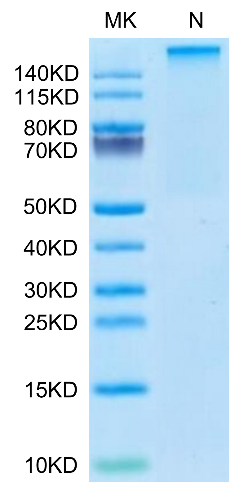 Human HLA-A*11:01&B2M&KRAS G12V (VVVGAVGVGK) Tetramer on Tris-Bis PAGE under Non reducing (N) condition. The purity is greater than 95%.Recombinant Human HLA-A*11:01&B2M&KRAS G12V (VVVGAVGVGK) Tetramer Protein