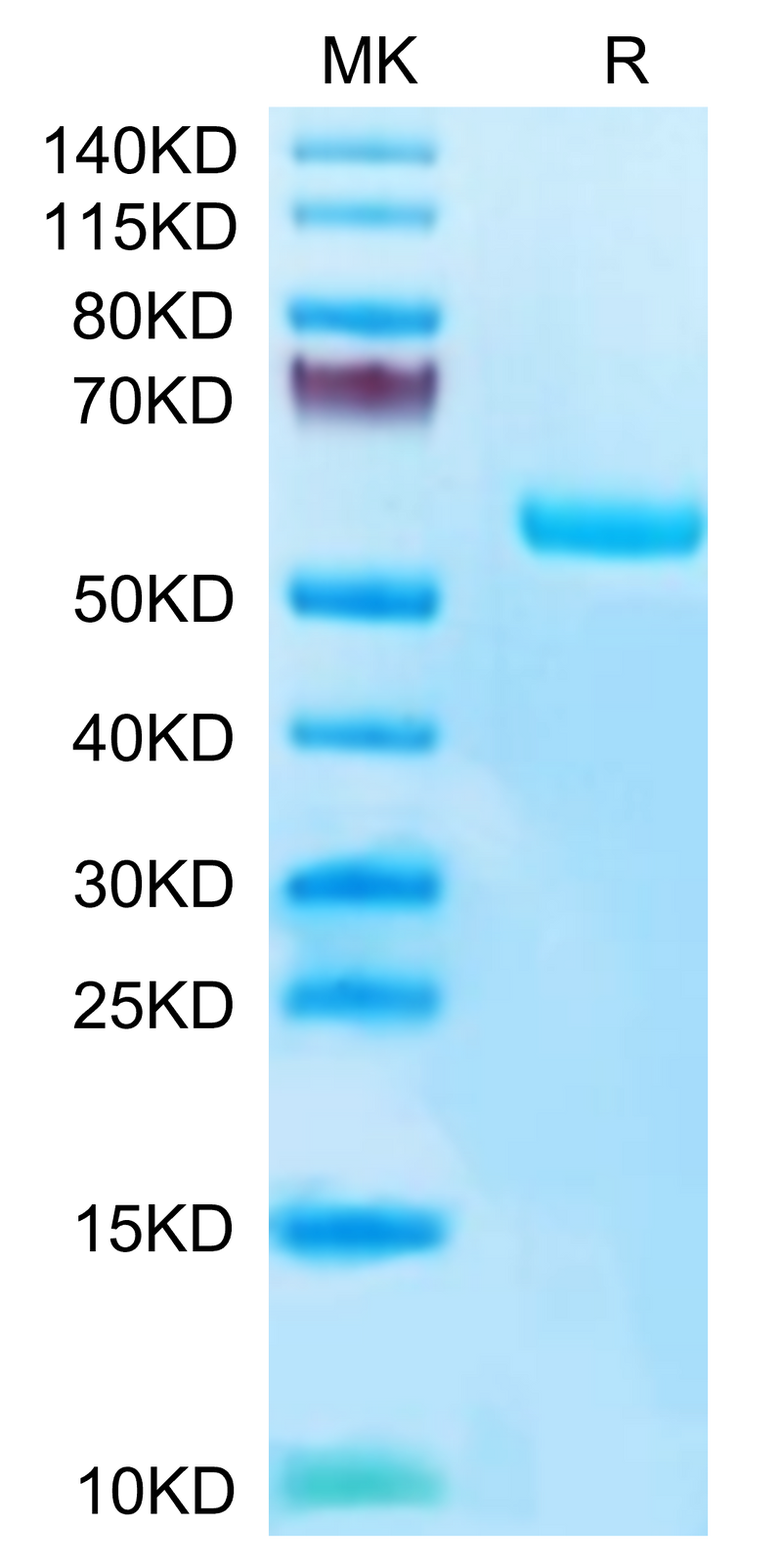 Human HLA-A*02:01&B2M&Survivin (LMLGEFLKL) Monomer on Tris-Bis PAGE under reduced condition. The purity is greater than 95%.Recombinant Human HLA-A*02:01&B2M&Survivin (LMLGEFLKL) Monomer Protein