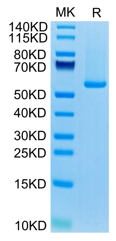Biotinylated Human GUCY2C on Tris-Bis PAGE under reduced condition. The purity is greater than 95%.Biotinylated Human GUCY2C/Guanylyl cyclase C Protein, Active