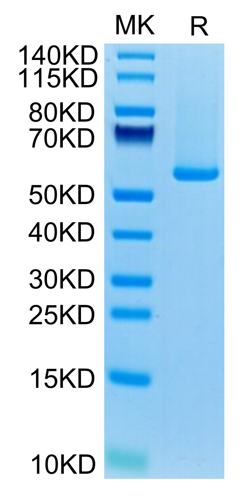 Biotinylated Human GUCY2C on Tris-Bis PAGE under reduced condition. The purity is greater than 95%.Biotinylated Human GUCY2C/Guanylyl cyclase C Protein, Active