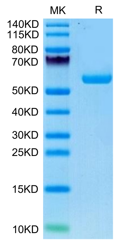 Human HLA-A*02:01&B2M&AFP (FMNKFIYEI) Monomer on Tris-Bis PAGE under reduced condition. The purity is greater than 95%.Recombinant Human HLA-A*02:01&B2M&AFP (FMNKFIYEI) Monomer Protein, Active
