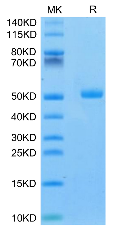 Mouse CA9 on Tris-Bis PAGE under reduced condition. The purity is greater than 95%.Recombinant Mouse CA9/Carbonic Anhydrase IX Protein