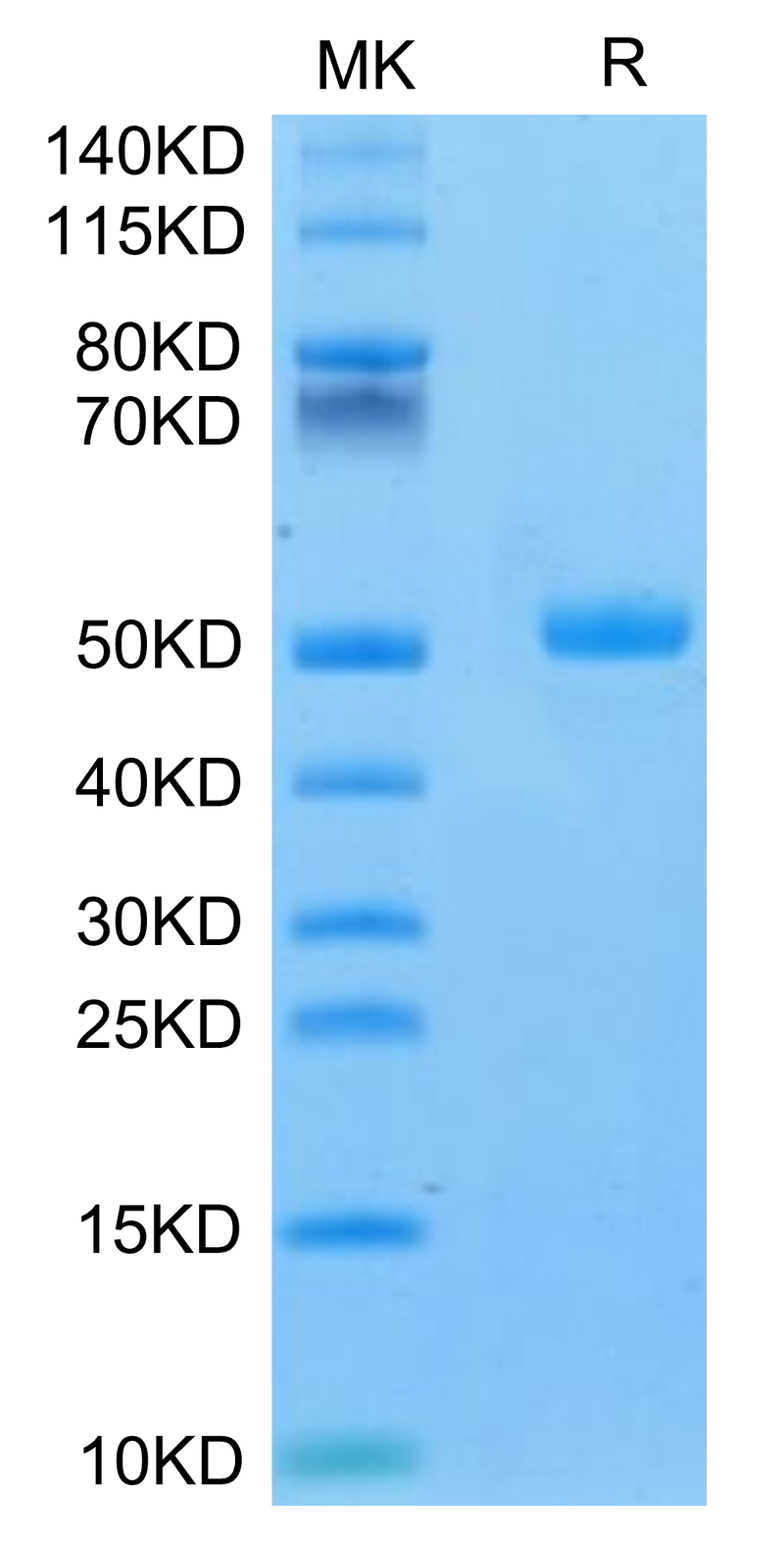 Mouse CA9 on Tris-Bis PAGE under reduced condition. The purity is greater than 95%.Recombinant Mouse CA9/Carbonic Anhydrase IX Protein