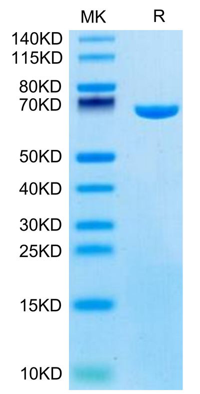 Mouse Serum Albumin on Tris-Bis PAGE under reduced condition. The purity is greater than 95%.Recombinant Mouse Serum Albumin Protein, Active