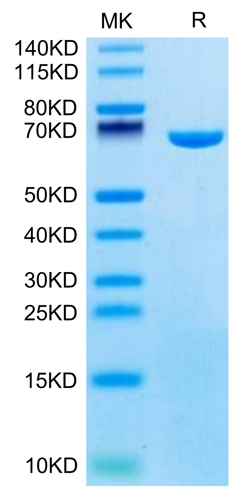 Mouse Serum Albumin on Tris-Bis PAGE under reduced condition. The purity is greater than 95%.Recombinant Mouse Serum Albumin Protein, Active
