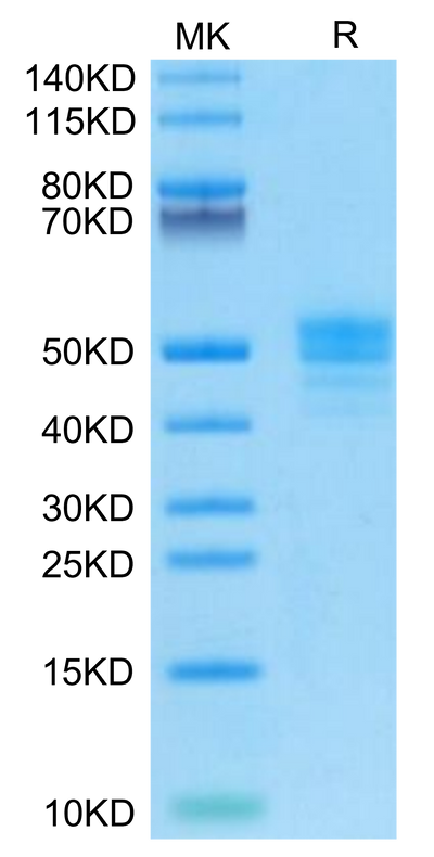 Human CD14 on Tris-Bis PAGE under reduced condition. The purity is greater than 95%.Recombinant Human CD14 Protein