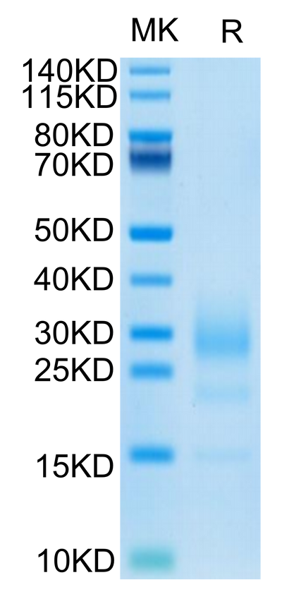 Mouse IL-5 on Tris-Bis PAGE under reduced condition. The purity is greater than 95%.Recombinant Mouse IL-5 Protein, Active