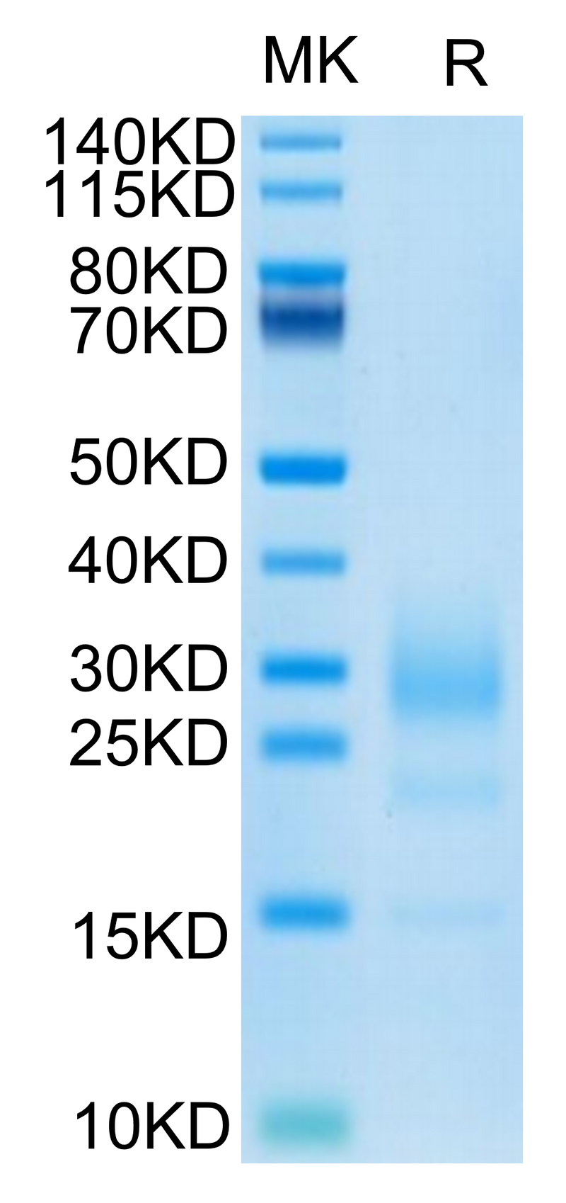 Mouse IL-5 on Tris-Bis PAGE under reduced condition. The purity is greater than 95%.Recombinant Mouse IL-5 Protein, Active