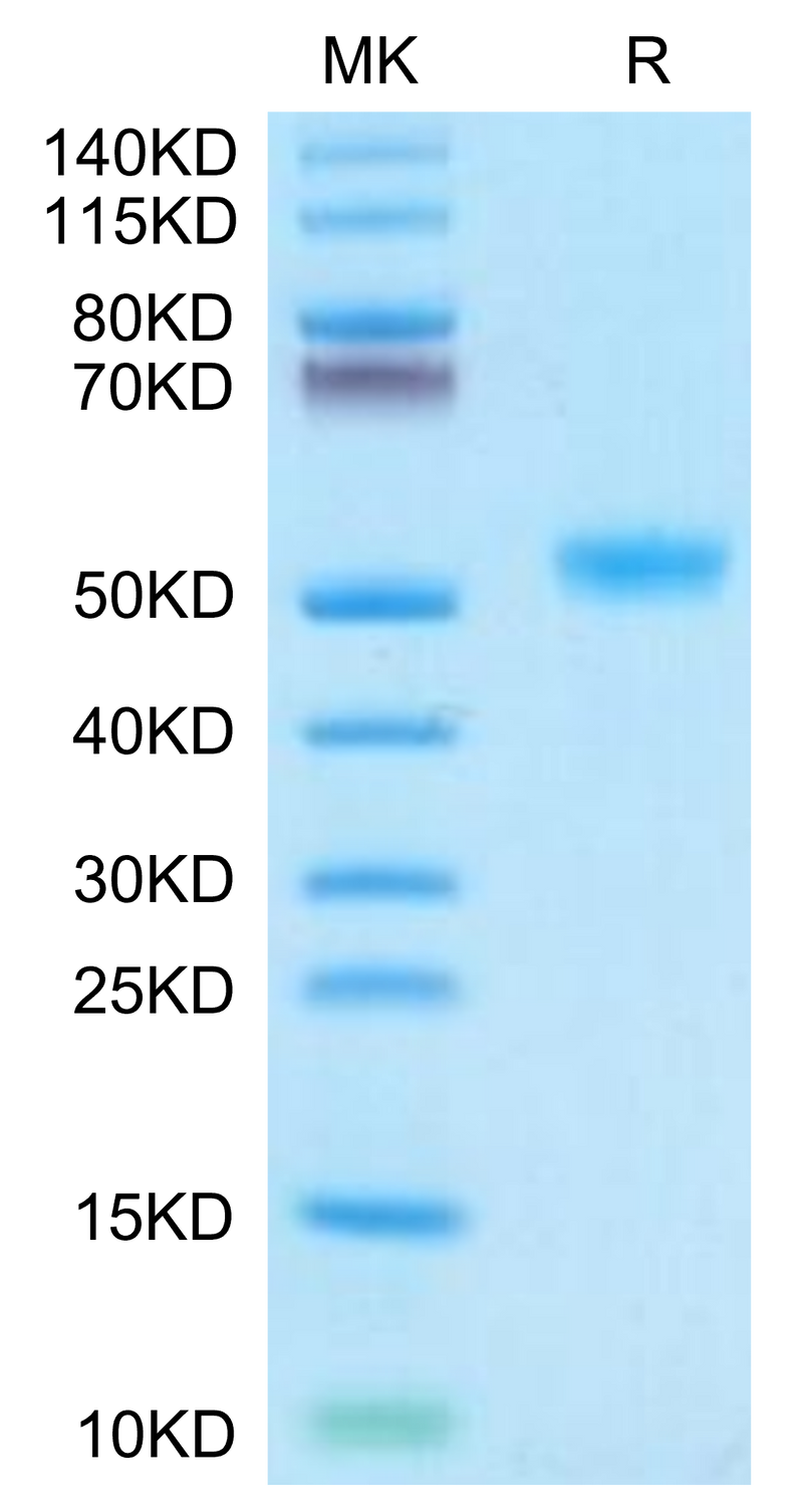 Human IL-11R alpha on Tris-Bis PAGE under reduced condition. The purity is greater than 95%.Recombinant Human IL-11R alpha Protein, Active