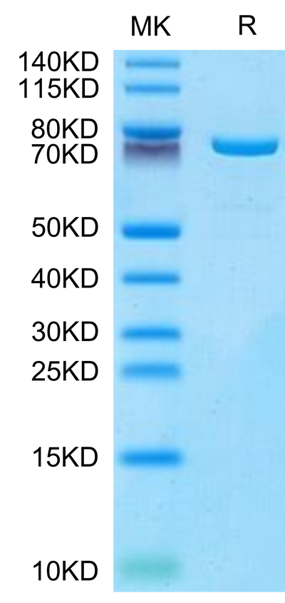 Mouse TGM2 on Tris-Bis PAGE under reduced condition. The purity is greater than 95%.Recombinant Mouse TGM2 Protein