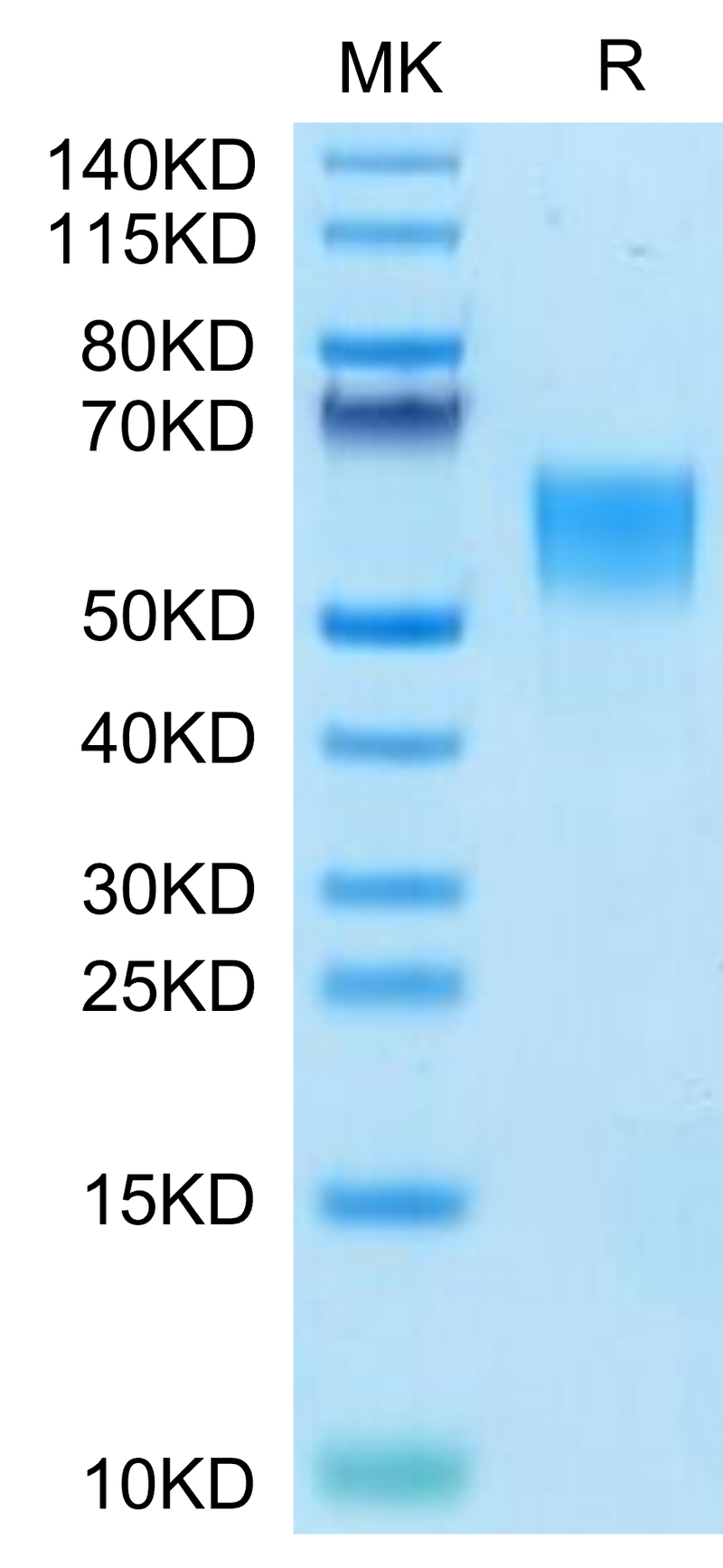 Human ENPP-3 (558-875) on Tris-Bis PAGE under reduced condition. The purity is greater than 95%.Recombinant Human ENPP-3 (558-875) Protein