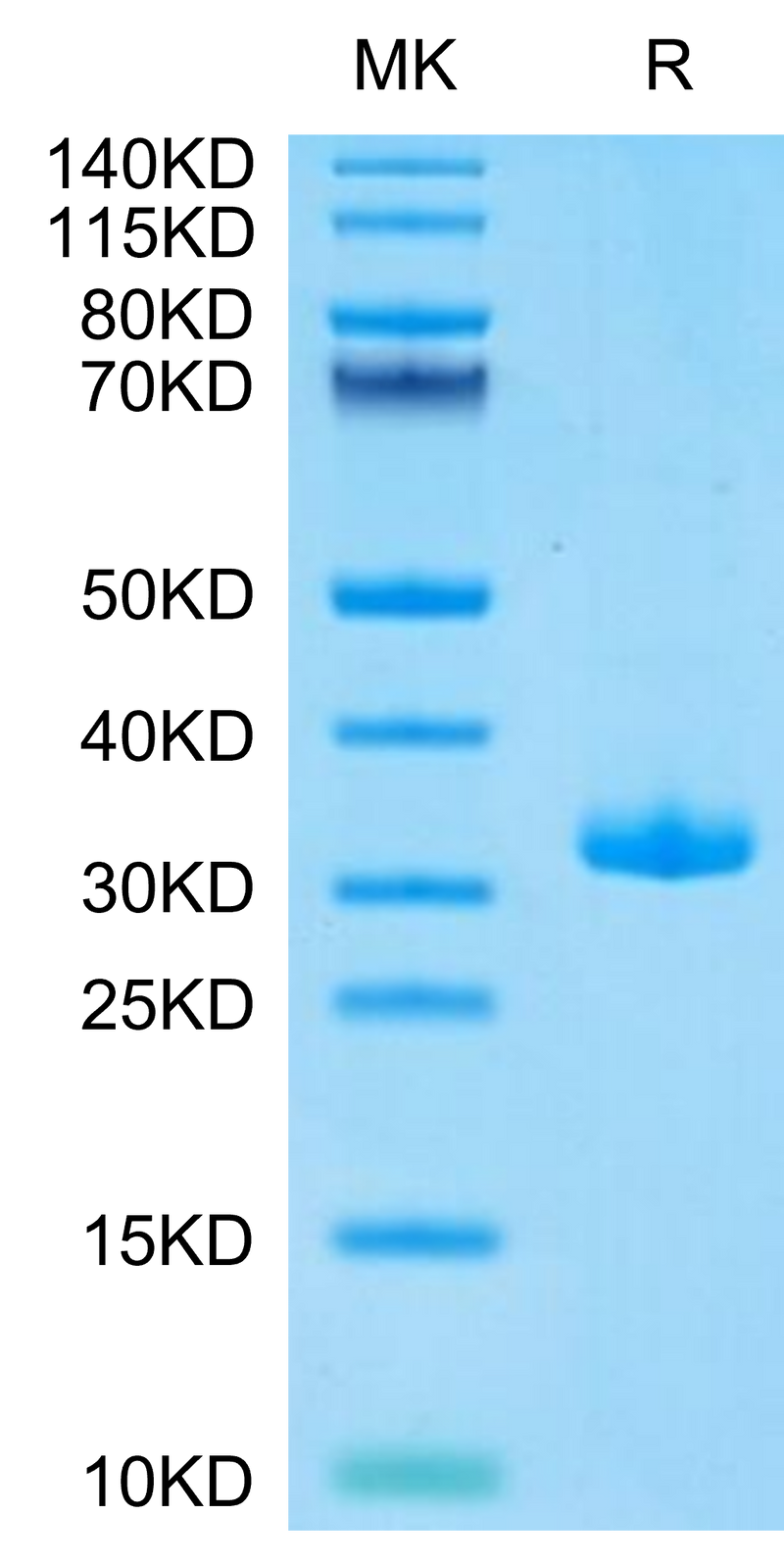 Biotinylated Human BTN3A1 on Tris-Bis PAGE under reduced condition. The purity is greater than 95%.Biotinylated Human BTN3A1/CD277 Protein, Active