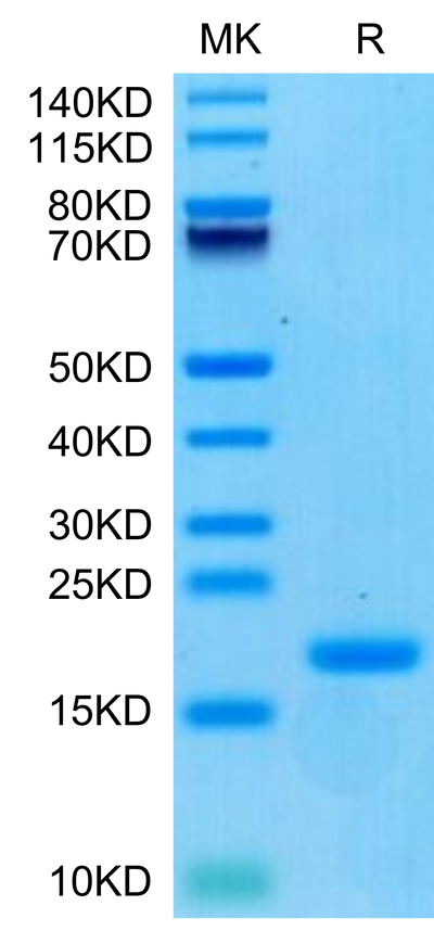 Biotinylated Human ENPP-3 (48-157) on Tris-Bis PAGE under reduced condition. The purity is greater than 95%.Biotinylated Human ENPP-3 (48-157) Protein