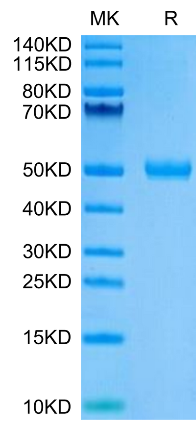 Human CYTL1 on Tris-Bis PAGE under reduced condition. The purity is greater than 95%.Recombinant Human CYTL1/C17 Protein