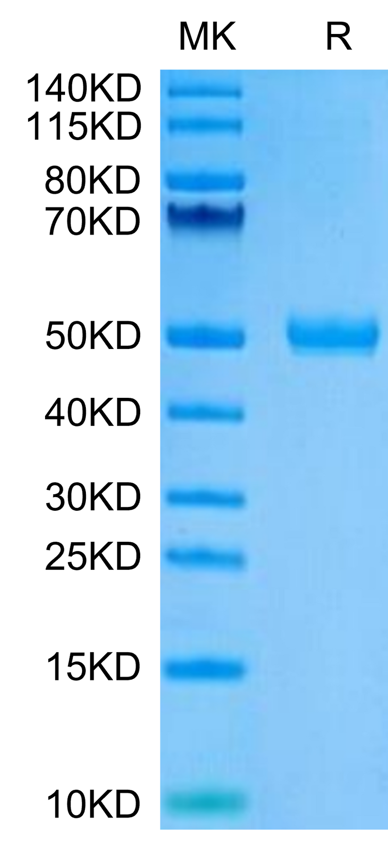 Human CYTL1 on Tris-Bis PAGE under reduced condition. The purity is greater than 95%.Recombinant Human CYTL1/C17 Protein