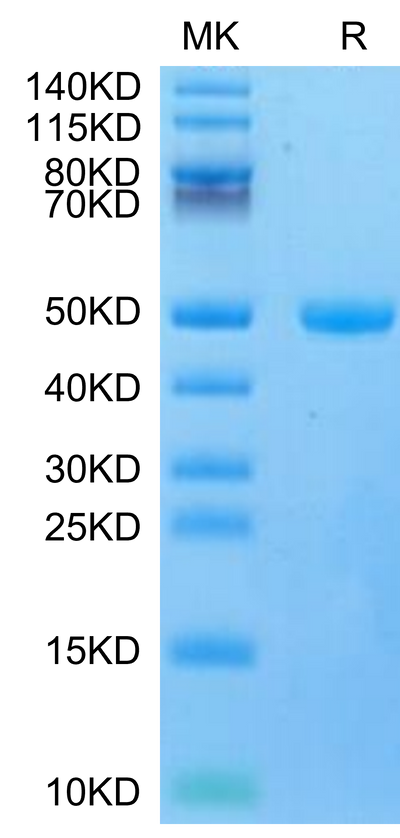 Mouse CYTL1 on Tris-Bis PAGE under reduced condition. The purity is greater than 95%.Recombinant Mouse CYTL1/C17 Protein