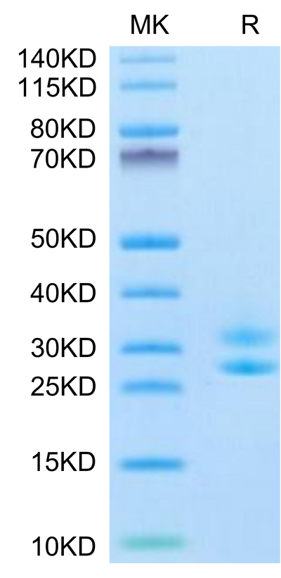 Biotinylated Human IL-15RA&IL-15 (Primary Amine Labeling) on Tris-Bis PAGE under reduced condition. The purity is greater than 95%.Biotinylated Human IL-15RA&IL-15 Protein (Primary Amine Labeling), Active
