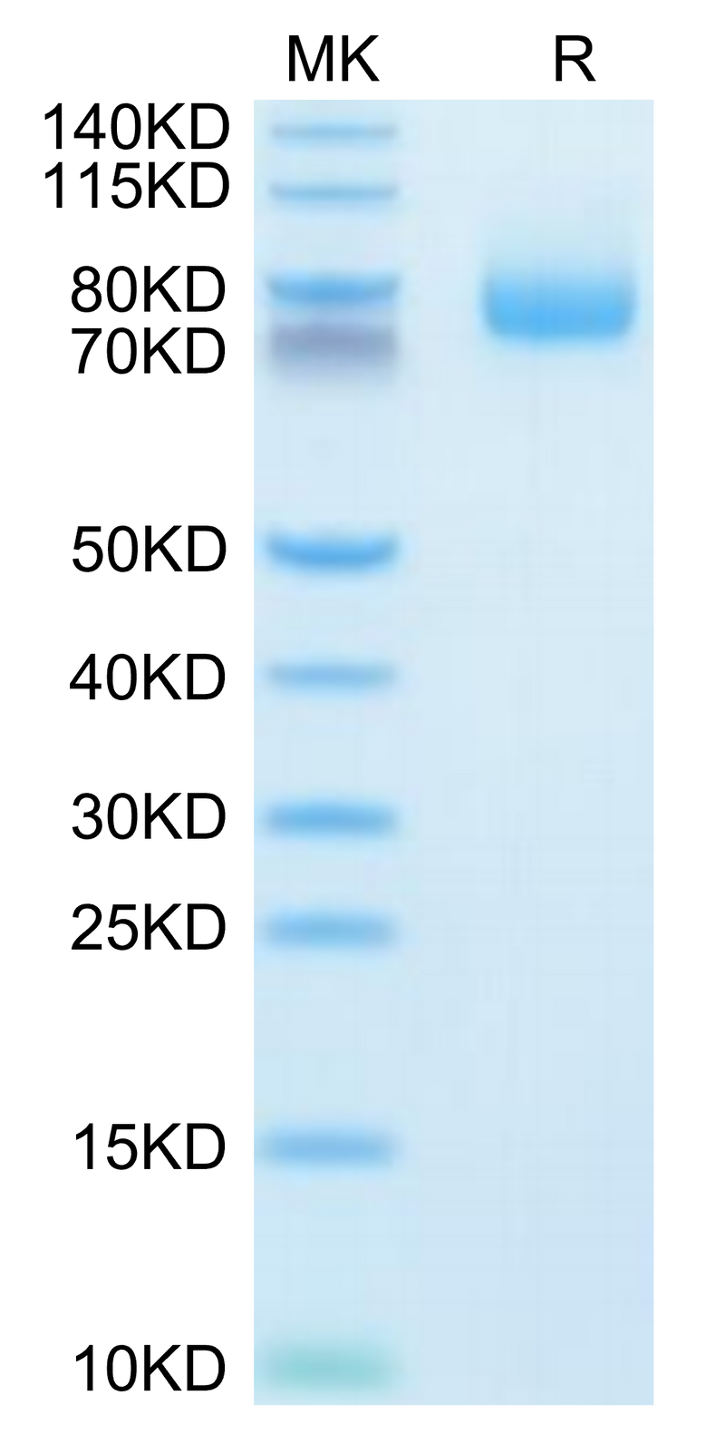 Human GITR Ligand (Trimer) on Tris-Bis PAGE under reduced condition. The purity is greater than 95%.Recombinant Human GITR Ligand/TNFSF18 Trimer Protein, Active