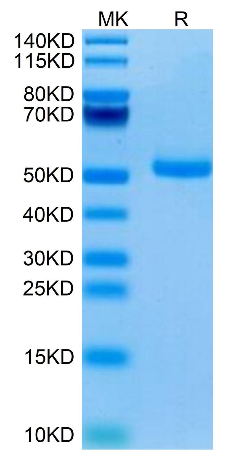Human TRAIL R1 on Tris-Bis PAGE under reduced condition. The purity is greater than 95%.Recombinant Human TRAIL R1/DR4/TNFRSF10A Protein, Active