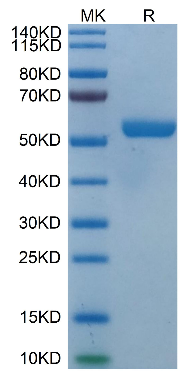 Human HLA-E*01:03&B2M&Peptide (VMAPRTLVL) Monomer on Tris-Bis PAGE under reduced condition. The purity is greater than 95%.Recombinant Human HLA-E*01:03&B2M&Peptide (VMAPRTLVL) Monomer Protein