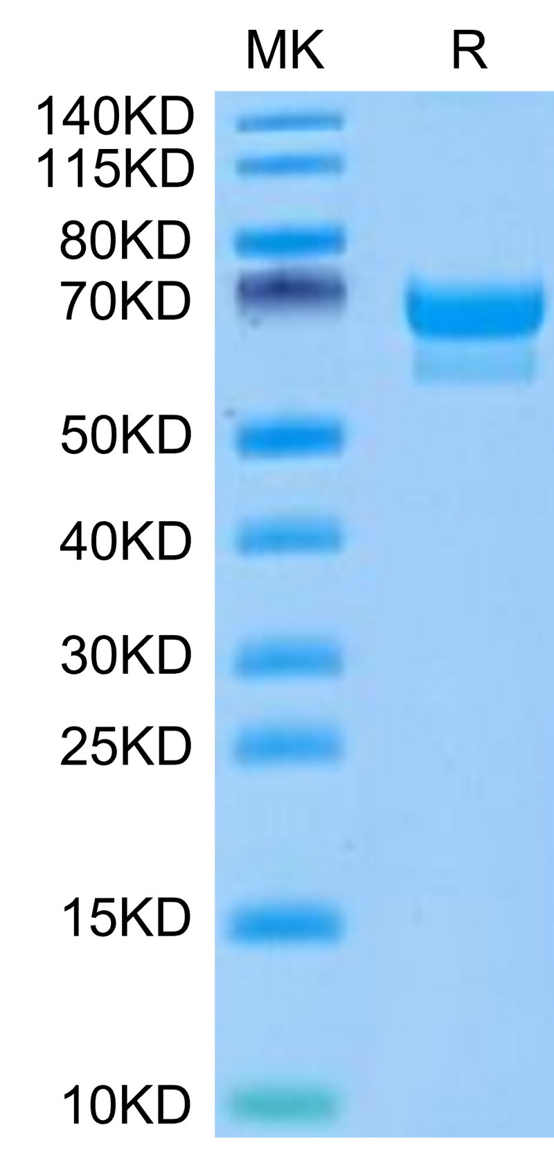 Canine PRLR on Tris-Bis PAGE under reduced condition. The purity is greater than 95%.Recombinant Canine PRLR Protein
