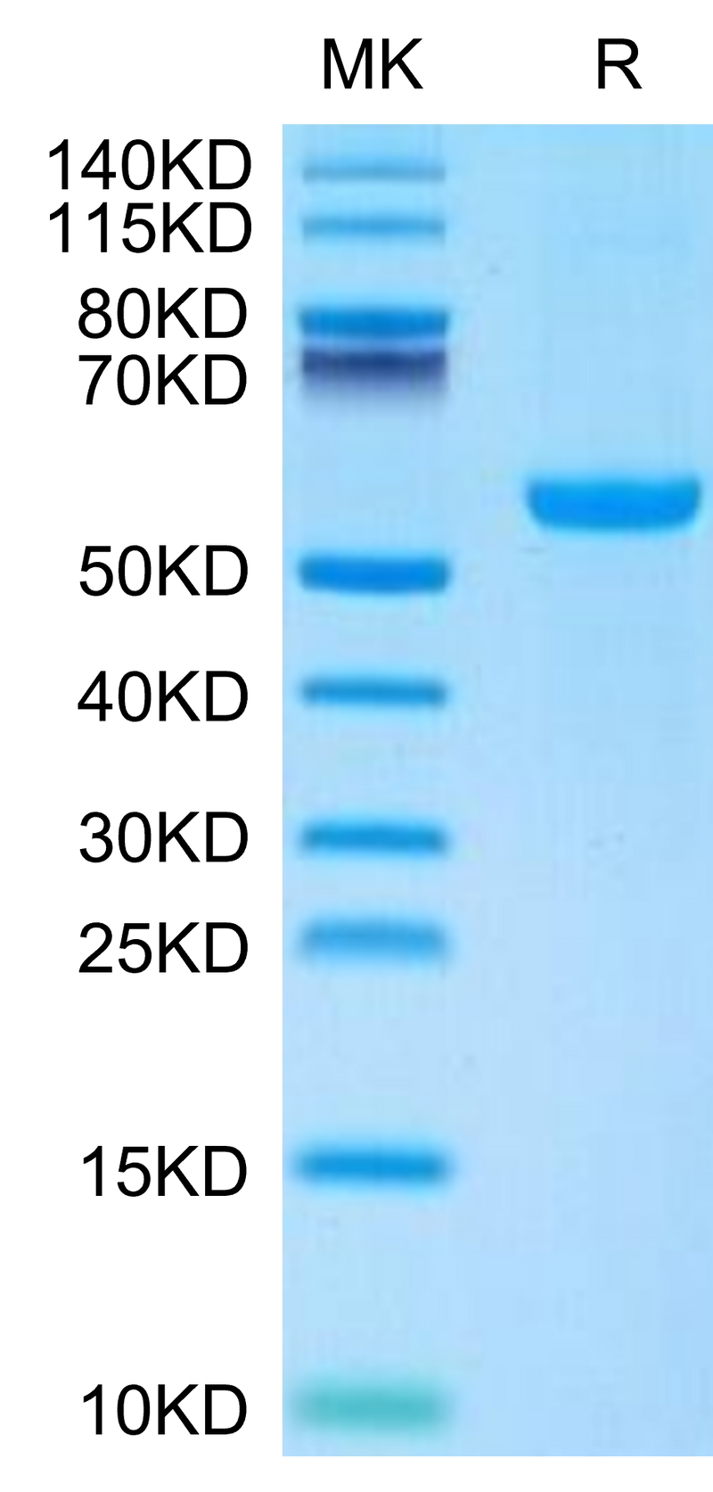 Mouse CD27 Ligand on Tris-Bis PAGE under reduced condition. The purity is greater than 95%.Recombinant Mouse CD27 Ligand/CD70 Protein, Active