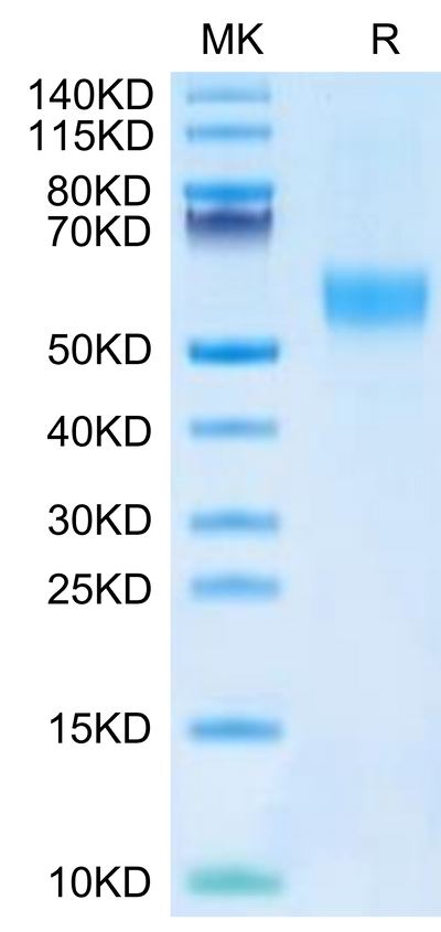 Mouse FGFR3 alpha (IIIb) on Tris-Bis PAGE under reduced condition. The purity is greater than 95%.Recombinant Mouse FGFR3 alpha (IIIb) Protein